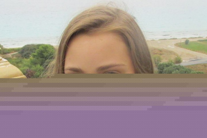 На 10 годишна възраст в следствие на рядка генна мутация